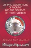 Graphic Illustrations Of Abortion And The Diseases Of Menstruation