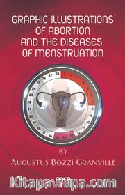 Graphic Illustrations Of Abortion And The Diseases Of Menstruation