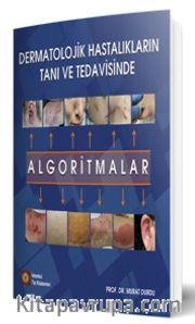 Dermatolojik Hastalıkların Tanı ve Tedavisinde Algoritmalar