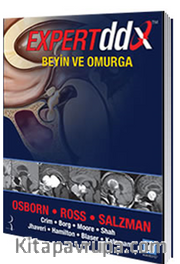 Expert DDX: Beyin ve Omurga