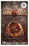 Anne Yarası