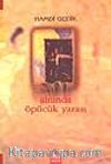 Alnında Öpücük Yarası