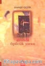 Alnında Öpücük Yarası