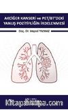 Akciğer Kanseri ve PET/BT'deki Yanlış Pozitifliğin İrdelenmesi