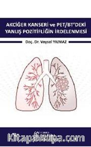 Akciğer Kanseri ve PET/BT'deki Yanlış Pozitifliğin İrdelenmesi