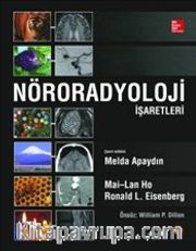 Nöroradyoloji İşaretleri