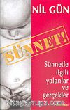 Sünnet
