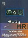 Body MRI - Tüm Vücut MRG